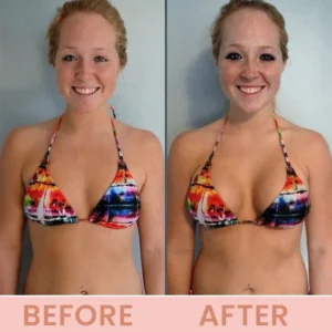 LIMETOW® Bust Lift Oil