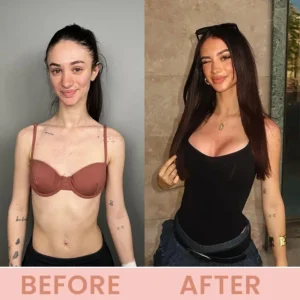 LIMETOW® Bust Lift Oil