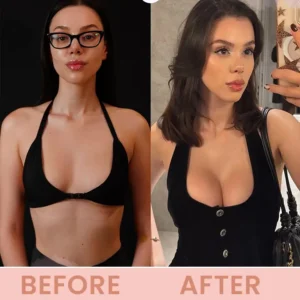 LIMETOW® Bust Lift Oil